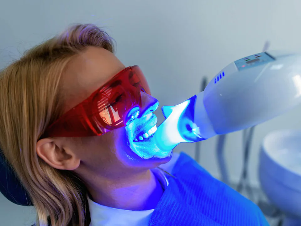Teeth Whitening in Remond, OR at Pacific Family Dental